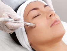 Crystal Microdermabrasion