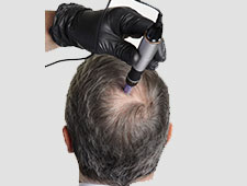 Stem Cells (Growth Factor)