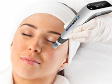 Dermapen Microneedling