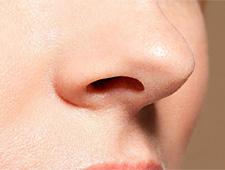 Rhinoplasty